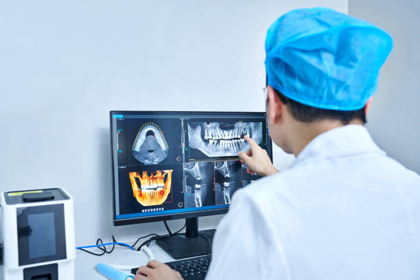Best Emergency Wisdom Teeth Removal in Ken Caryl, CO